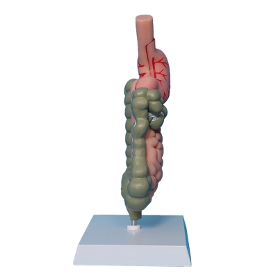 Патологическая модель толстой кишки желудочно-кишечного тракта Corpo GIT-6